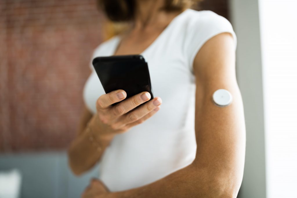 continuous glucose monitoring